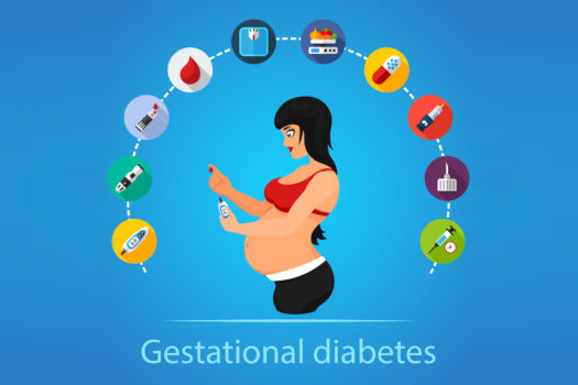 Gestational Diabetes and Pregnancy - Risk Factors and Treatment